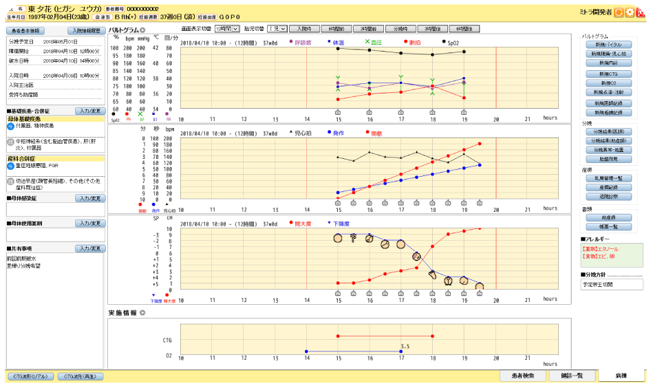 周産期電子カルテシステム パトルグラム画面例