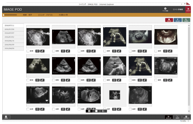 妊産婦ごとの画像比較閲覧機能